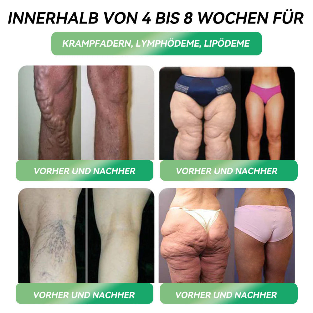 【✅Offizieller Shop】STDEI® GLP-1 Trinkampullen zur Gewichtsreduktion